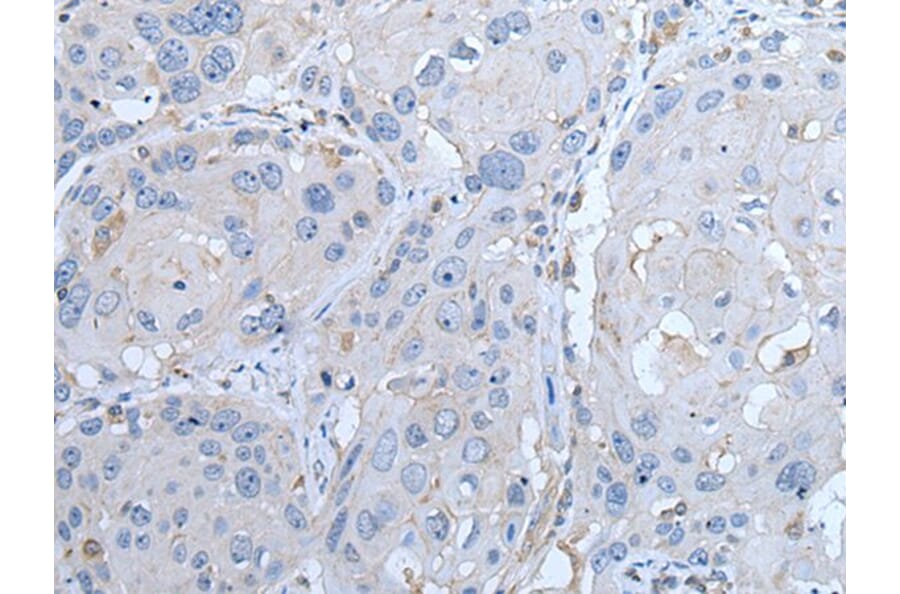 LTBP4 Antibody from Signalway Antibody (43963) - Antibodies.com