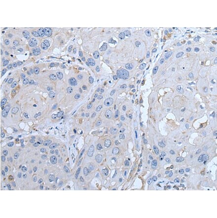 LTBP4 Antibody from Signalway Antibody (43963) - Antibodies.com