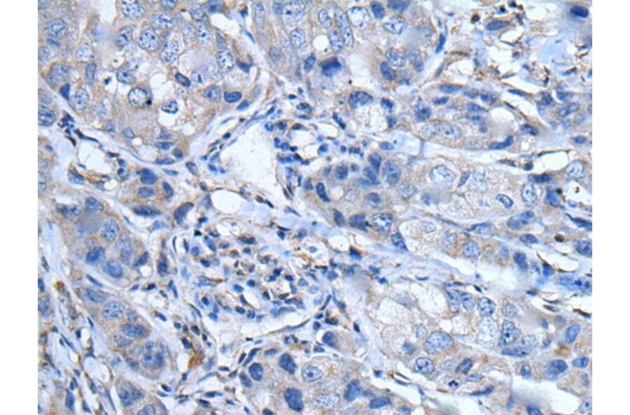 LTBP4 Antibody from Signalway Antibody (43963) - Antibodies.com