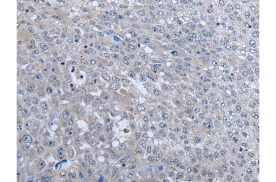 MTHFR Antibody from Signalway Antibody (43966) - Antibodies.com