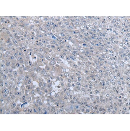 MTHFR Antibody from Signalway Antibody (43966) - Antibodies.com