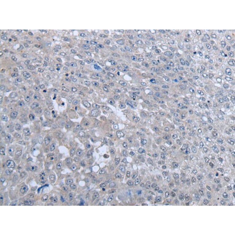 MTHFR Antibody from Signalway Antibody (43966) - Antibodies.com