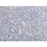 MTHFR Antibody from Signalway Antibody (43966) - Antibodies.com