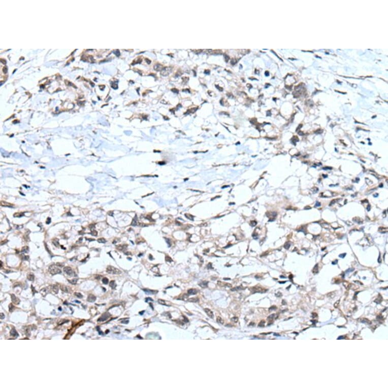 MTHFR Antibody from Signalway Antibody (43966) - Antibodies.com