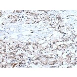 MTHFR Antibody from Signalway Antibody (43966) - Antibodies.com