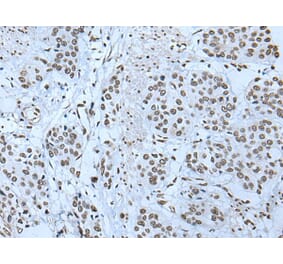 ZBTB4 Antibody from Signalway Antibody (43968) - Antibodies.com