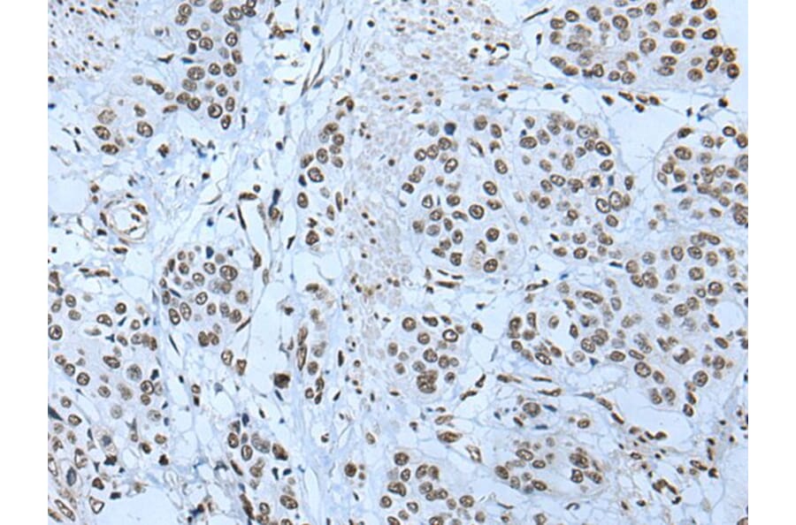 ZBTB4 Antibody from Signalway Antibody (43968) - Antibodies.com