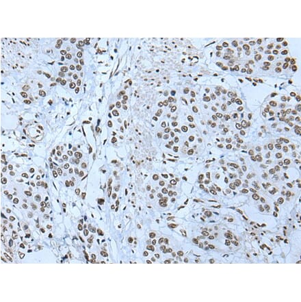 ZBTB4 Antibody from Signalway Antibody (43968) - Antibodies.com