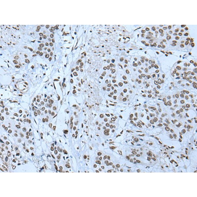 ZBTB4 Antibody from Signalway Antibody (43968) - Antibodies.com