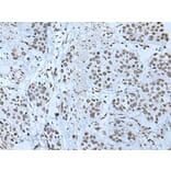 ZBTB4 Antibody from Signalway Antibody (43968) - Antibodies.com