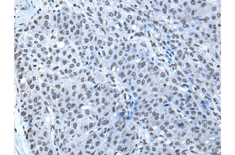 ZBTB4 Antibody from Signalway Antibody (43968) - Antibodies.com