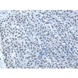 ZBTB4 Antibody from Signalway Antibody (43968) - Antibodies.com