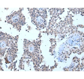 ZMYM2 Antibody from Signalway Antibody (43970) - Antibodies.com