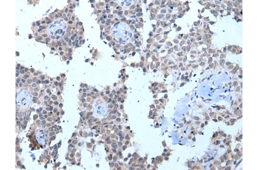 ZMYM2 Antibody from Signalway Antibody (43970) - Antibodies.com