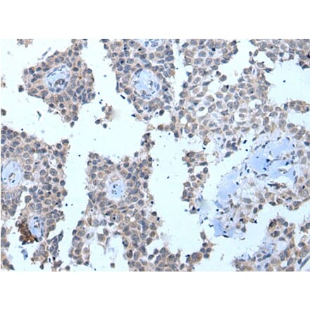 ZMYM2 Antibody from Signalway Antibody (43970) - Antibodies.com