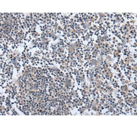WNT5A Antibody from Signalway Antibody (43980) - Antibodies.com