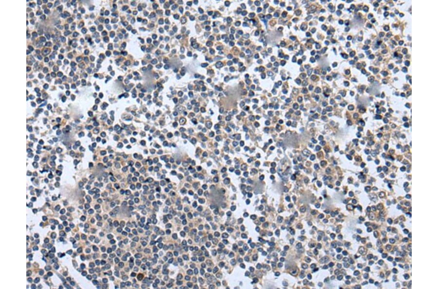 WNT5A Antibody from Signalway Antibody (43980) - Antibodies.com