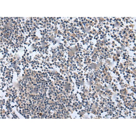 WNT5A Antibody from Signalway Antibody (43980) - Antibodies.com