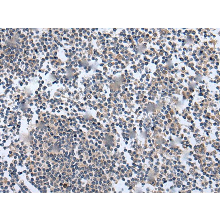 WNT5A Antibody from Signalway Antibody (43980) - Antibodies.com