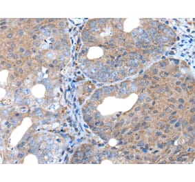 UNC5B Antibody from Signalway Antibody (43988) - Antibodies.com