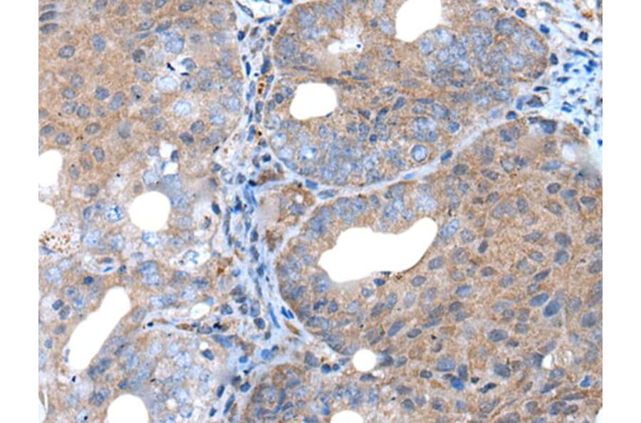 UNC5B Antibody from Signalway Antibody (43988) - Antibodies.com