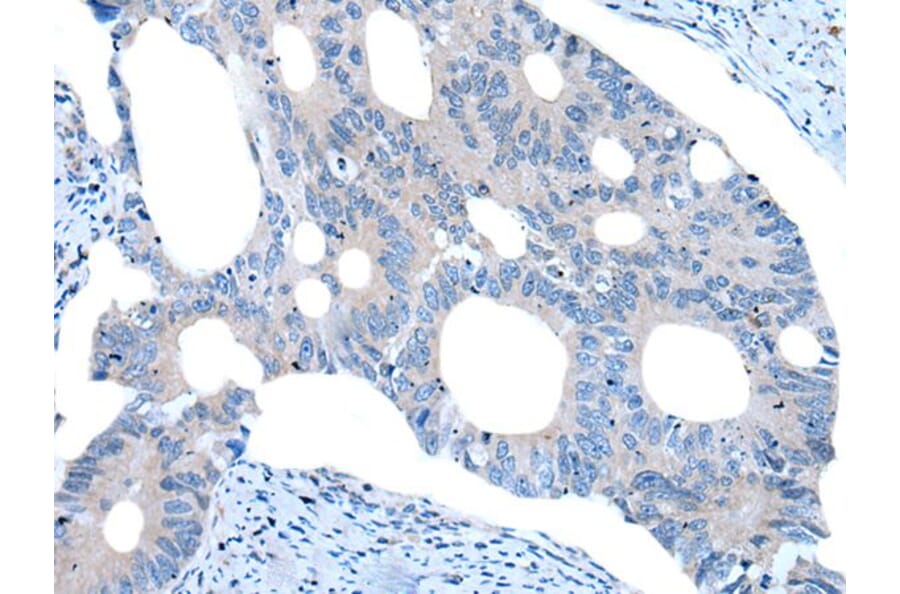 UNC5B Antibody from Signalway Antibody (43988) - Antibodies.com