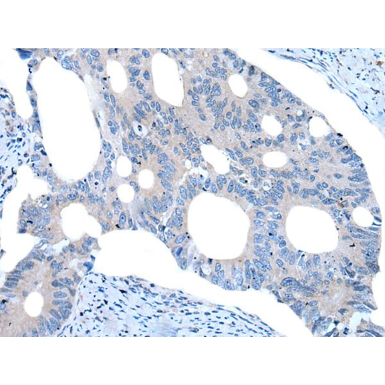 UNC5B Antibody from Signalway Antibody (43988) - Antibodies.com
