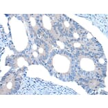 UNC5B Antibody from Signalway Antibody (43988) - Antibodies.com