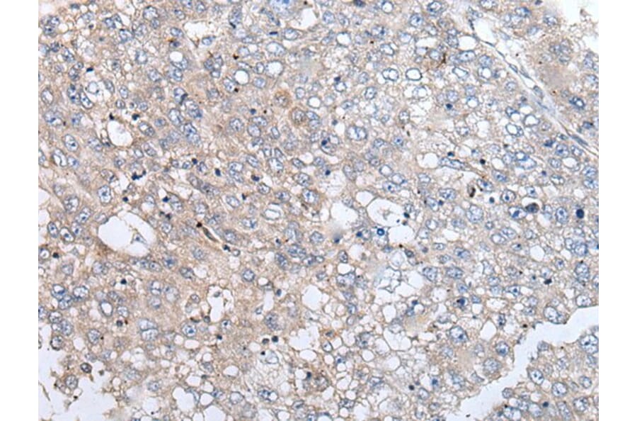 URGCP Antibody from Signalway Antibody (43989) - Antibodies.com