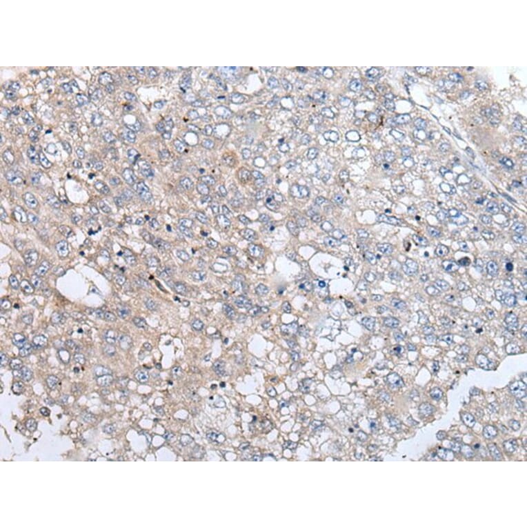 URGCP Antibody from Signalway Antibody (43989) - Antibodies.com
