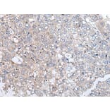 URGCP Antibody from Signalway Antibody (43989) - Antibodies.com