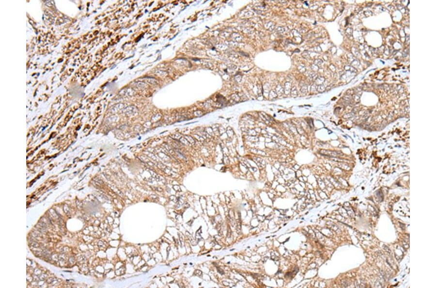ENPEP Antibody from Signalway Antibody (43994) - Antibodies.com