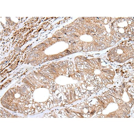 ENPEP Antibody from Signalway Antibody (43994) - Antibodies.com