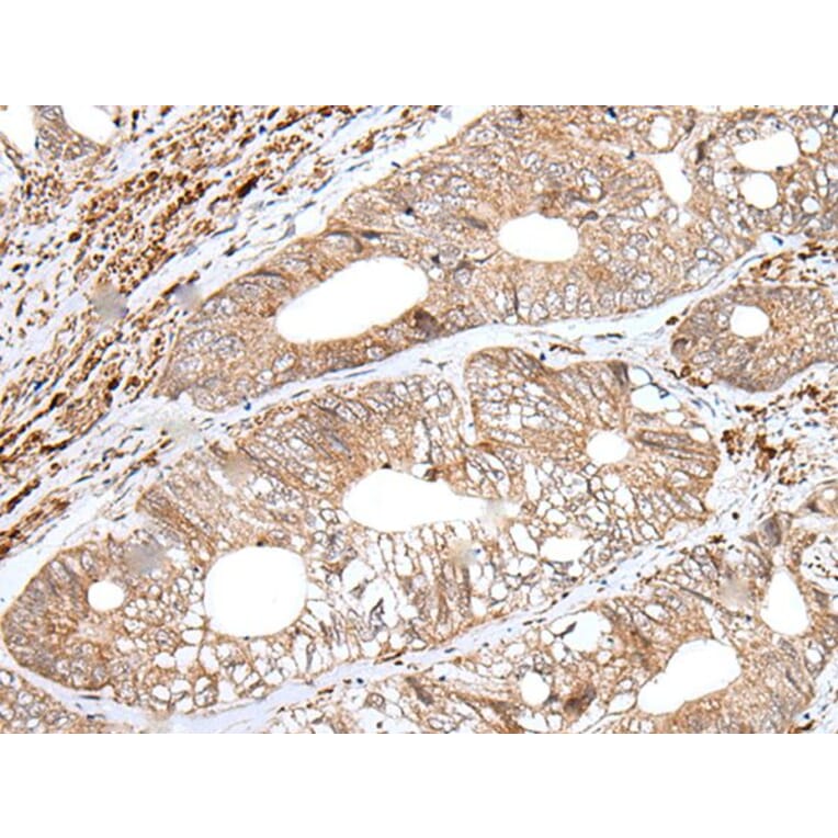 ENPEP Antibody from Signalway Antibody (43994) - Antibodies.com