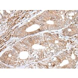 ENPEP Antibody from Signalway Antibody (43994) - Antibodies.com
