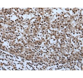 CELF5 Antibody from Signalway Antibody (43995) - Antibodies.com