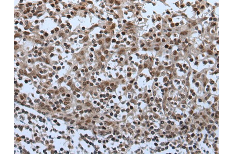 CELF5 Antibody from Signalway Antibody (43995) - Antibodies.com