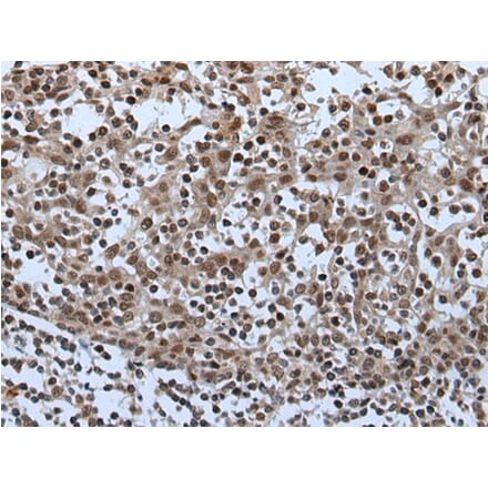 CELF5 Antibody from Signalway Antibody (43995) - Antibodies.com