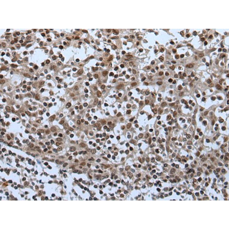 CELF5 Antibody from Signalway Antibody (43995) - Antibodies.com