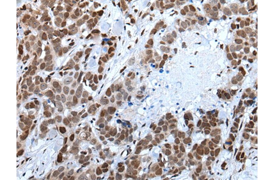 CELF5 Antibody from Signalway Antibody (43995) - Antibodies.com