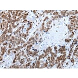 CELF5 Antibody from Signalway Antibody (43995) - Antibodies.com