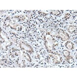 BSPRY Antibody from Signalway Antibody (43996) - Antibodies.com