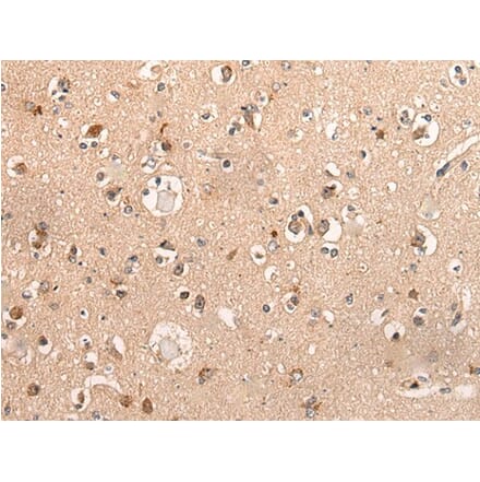 DYNAP Antibody from Signalway Antibody (44001) - Antibodies.com