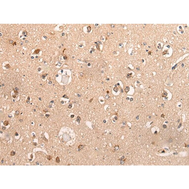 DYNAP Antibody from Signalway Antibody (44001) - Antibodies.com