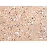 DYNAP Antibody from Signalway Antibody (44001) - Antibodies.com