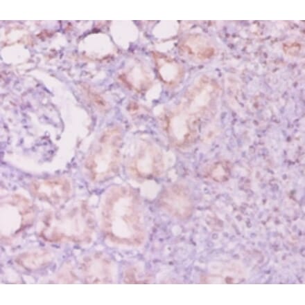 Immunohistochemistry - Angiopoietin-2 Polyclonal Antibody from Signalway Antibody (42440) - Antibodies.com