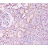 Immunohistochemistry - Angiopoietin-2 Polyclonal Antibody from Signalway Antibody (42440) - Antibodies.com