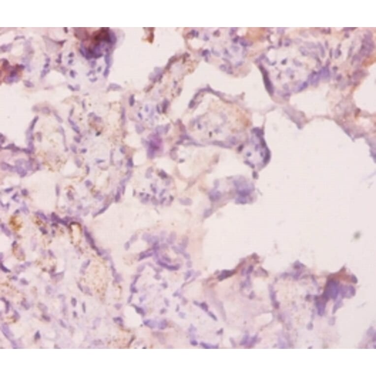 Immunohistochemistry - Angiopoietin-2 Polyclonal Antibody from Signalway Antibody (42440) - Antibodies.com