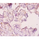 Immunohistochemistry - Angiopoietin-2 Polyclonal Antibody from Signalway Antibody (42440) - Antibodies.com