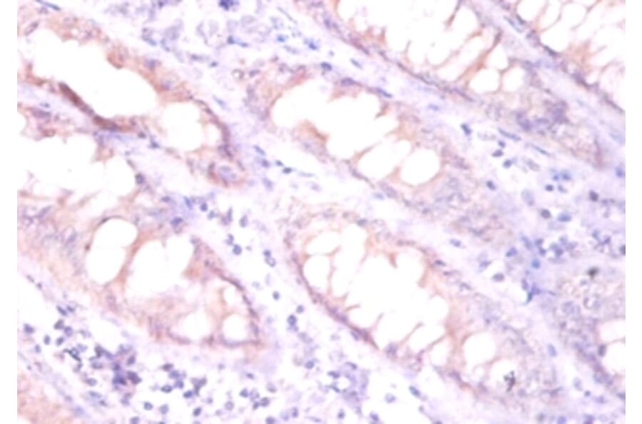 Immunohistochemistry - Erythropoietin Polyclonal Antibody from Signalway Antibody (42454) - Antibodies.com
